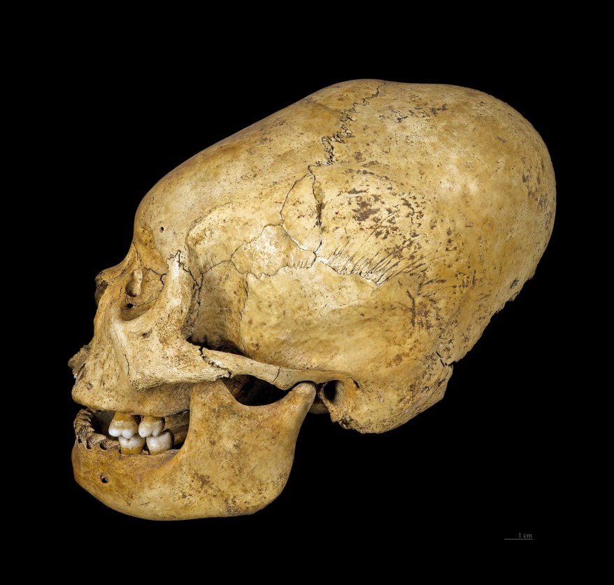 ACD Skull.jpg